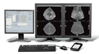 Imagen: Un captura de pantalla de la técnica de Mamografía Espectral Realzada por Contraste SenoBright (CESM) (Foto cortesía de GE Healthcare).